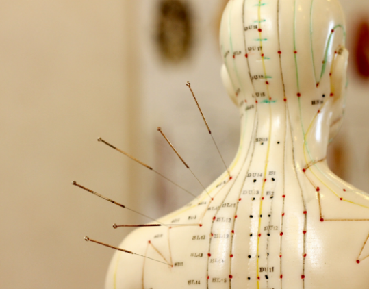 Acupuncteur